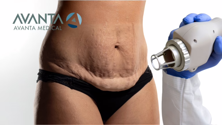 CO2 laser skin tightening is the clinical solution for loose skin after weight loss. See how the CO2Pro helps clinics serve GLP-1 patients and grow revenue with premium body treatments.